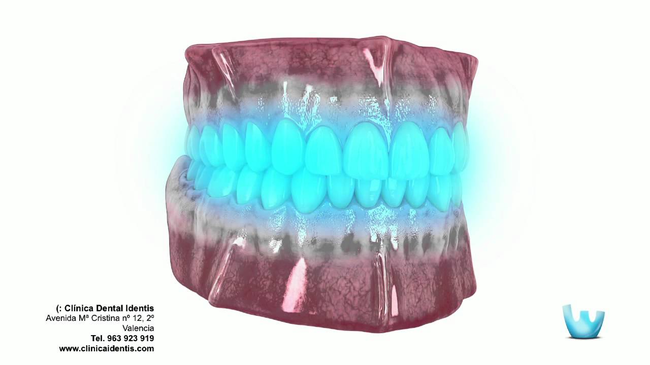 Jose David Torres Hernandez-36