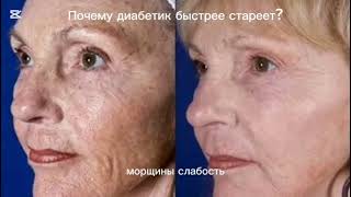 Почему диабетик стареет быстрее? #сахарныйдиабет