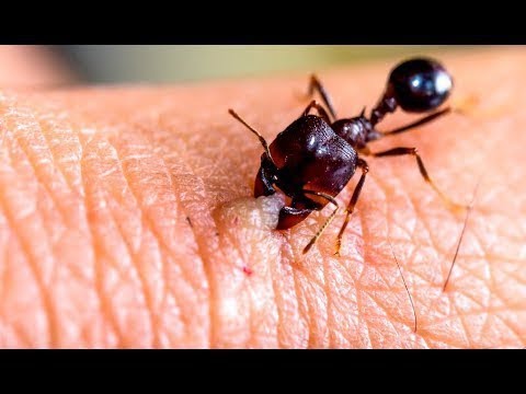 10 insetti nocivi da evitare a tutti i costi!