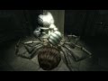 HD Zelda Twilight Princess Boss 6 ARMOGOHMA