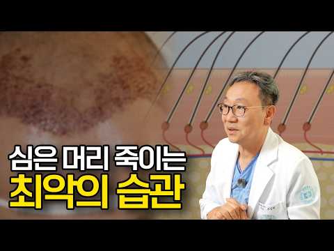 모발이식 하고 이것 하면 심은 머리 다 망칩니다