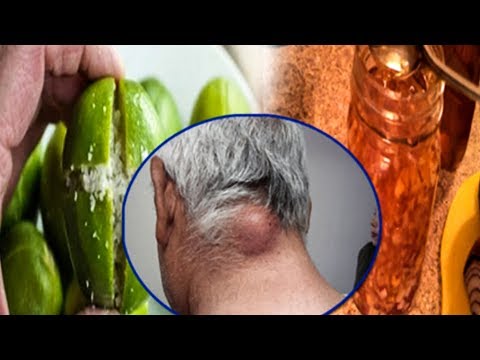Симптомы боли в мышцах и суставах Суставы болят лечение санаторий