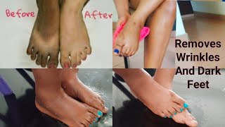 APPLY OVERNIGHT TO SOFTEN AND BRIGHTEN DARK FEET REMOVE WRINKLES FROM  FEET