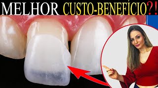 O que é melhor, Faceta Dental, Lente de Contato de Porcelana ou Resina, qual melhor custo-benefício