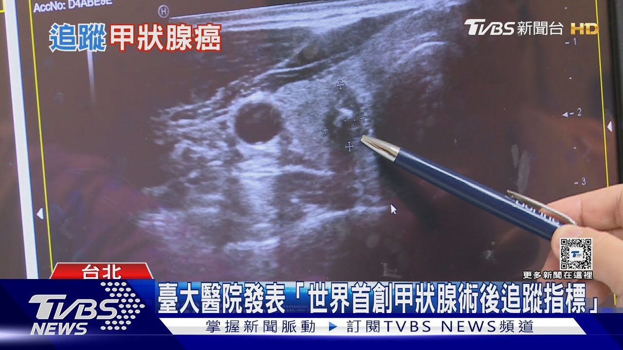 頸部「這位置」異常腫大罹癌機率增!醫師警告:勿輕忽「這件事」