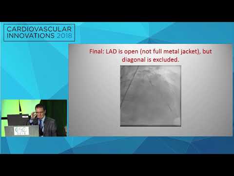 CVI2018 Session: CHIP Part 2: The Foundation of CTO PCI