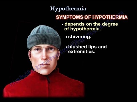 Hypothermia , UPDATE - Everything You Need To Know - Dr. Nabil Ebraheim