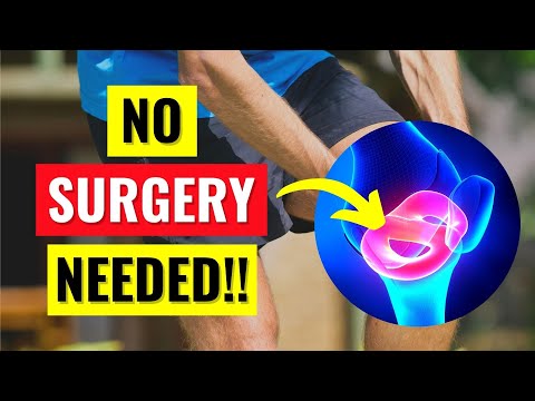 Why You Don't Need Surgery For Your Meniscus Tear