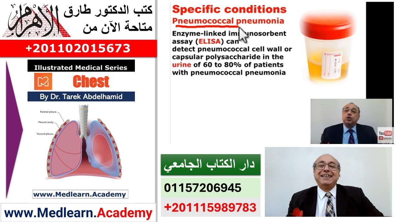 Pneumonia (Extra Points) [B]  #cme #internal_medicine #medical #usmle #محاضرات_باطنة