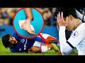 Andre Gomes Gruesome Injury Leaves Players In Tears