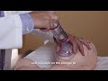The Dechoker Anti Choking Device