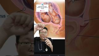 Download lagu Can I Have a Natural Birth with Twins? #shorts #askthedoctor mp3