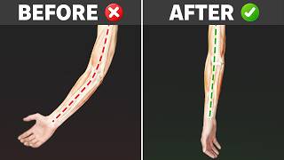 90% of Elbow Pain Comes from THIS