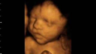 preview picture of video 'Beautiful 3D 4D baby bonding scan'
