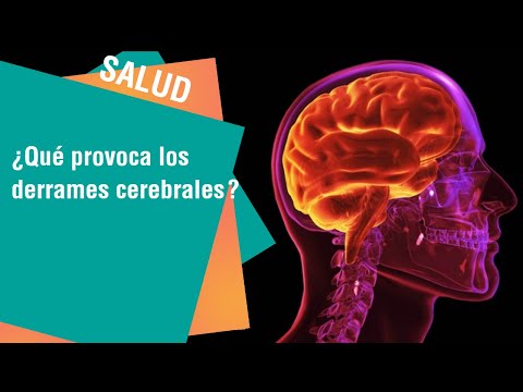 download lagu mp3 mp4 Derrame Cerebral, download lagu Derrame Cerebral gratis, unduh video klip Derrame Cerebral