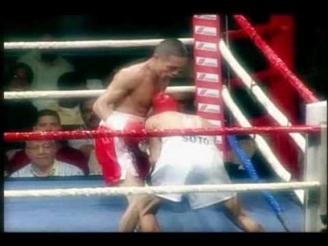Juan Palacios vs Soto