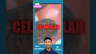 Download lagu Kenapa Kentut itu Bau? Cek Faktanya Disini! #shorts #kentut #bau mp3