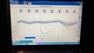Injector balance test on 6.7