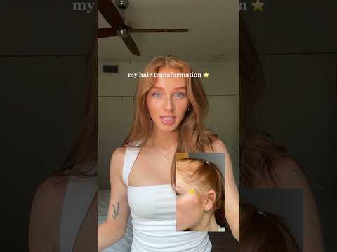 Divi scalp serum is my hero