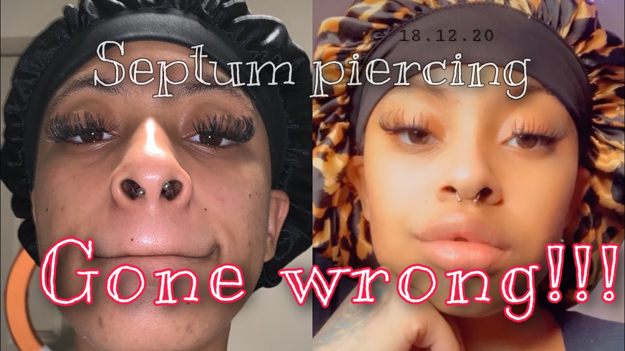 Septum experience gone wrong re pierced for 3rd time!!!