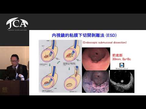 栄養学科 講演1「研究が切り拓く　消化管がん治療の最前線」吉田 和弘（岐阜大学大学院腫瘍制御学講座腫瘍外科学分野 教授）