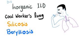 Silicosis, Berylliosis & Coal Worker's Pneumoconiosis | Interstitial Pulmonary Fibrosis