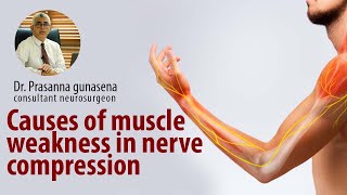 Muscle weakness from nerve compression | Dr Prasanna Gunasena