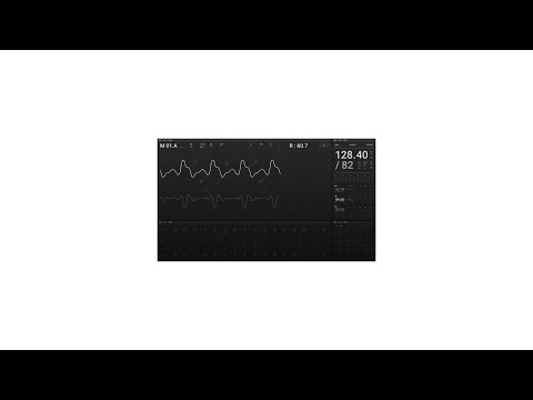 Video thumbnail for I STILL LOVE YOU