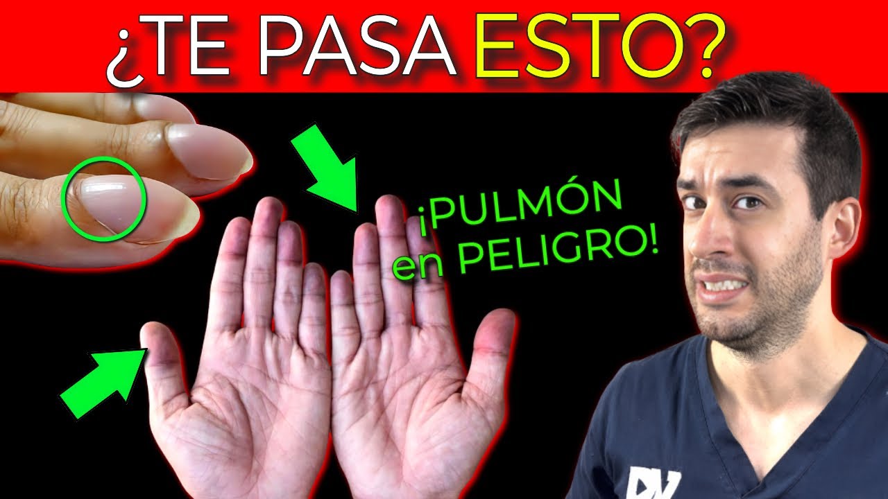 How to GET RID of Phlegm in Your CHEST| MUCUS in the LUNGS