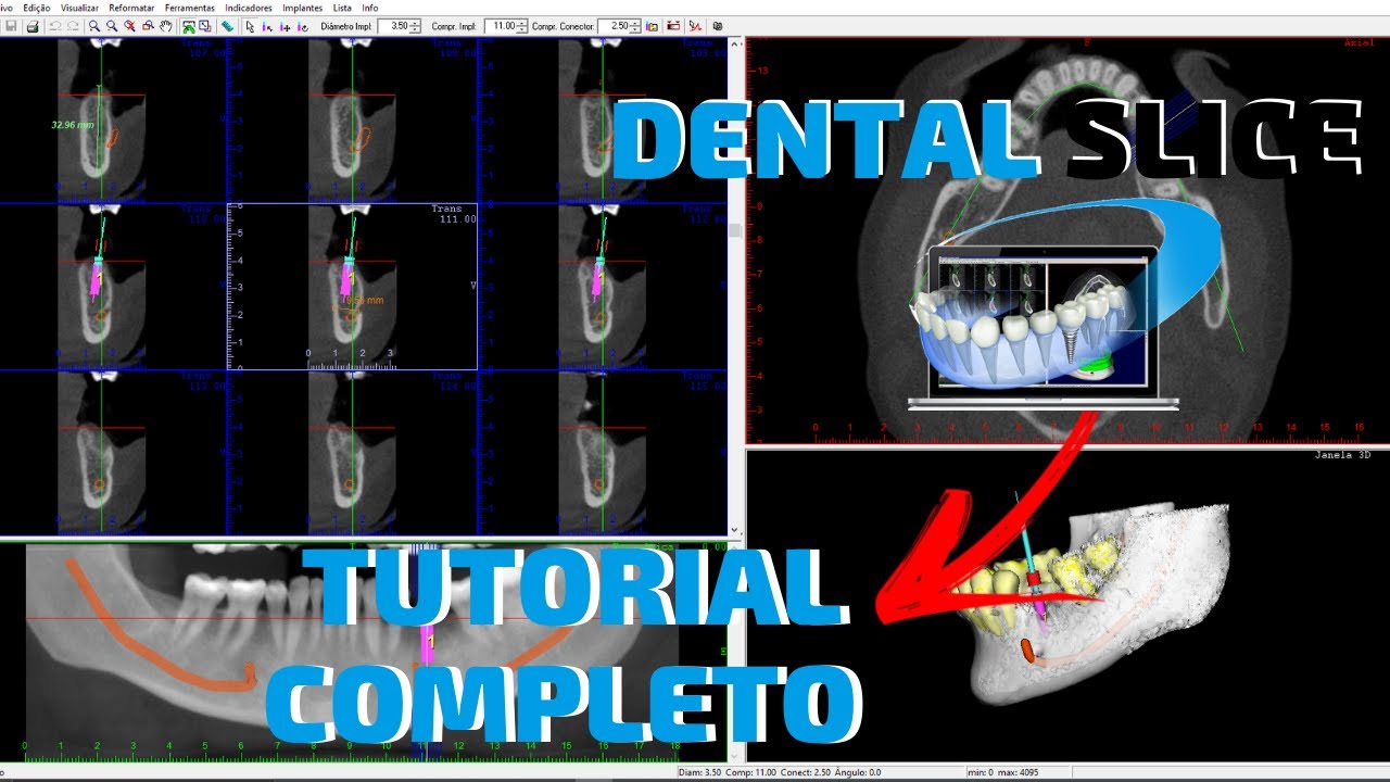 Descubra como usar o Dental Slice de uma forma SIMPLES e FÁCIL!