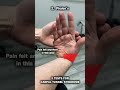 3 Tests For Carpal Tunnel Syndrome