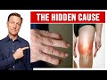 The Hidden Cause of Arthritis in Your Knees and Hands