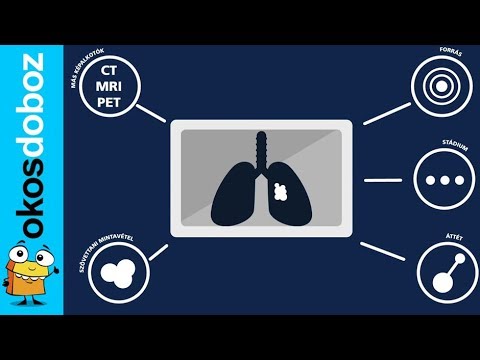 Dohányzói köpet, amikor abbahagyja a dohányzást, A tüdő állapota - Biopszia és köpetvizsgálat