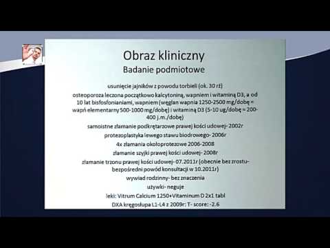 Osteoporoza kiedy leczenie może być groźniejsze od samej choroby