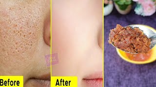 Download lagu Keajaiban Wajah Seperti Ini Akan Anda Dapatkan Dalam 1 Malam || Dodi Satria mp3