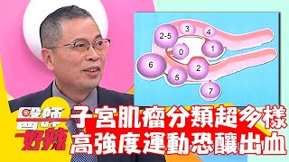 子宮肌瘤分類超多樣！高強度運動恐釀「出血」？！【#醫師好辣】20221108 part2 EP1445 吳昭寬 關韶文