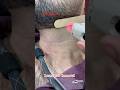 Laser Hair Removal Treatment Getsmarthairclub Hair Viralvideo Hairremoval