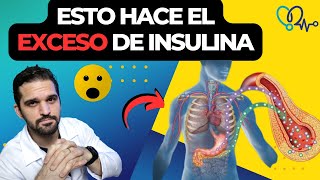 Lo que NO sabias sobre la INSULINA ALTA y resistencia. como REVERTIRLA😲✅