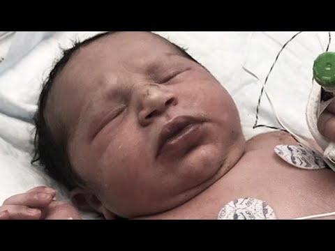 download lagu mp3 mp4 Child Deaths From Plastic Bags, download lagu Child Deaths From Plastic Bags gratis, unduh video klip Child Deaths From Plastic Bags
