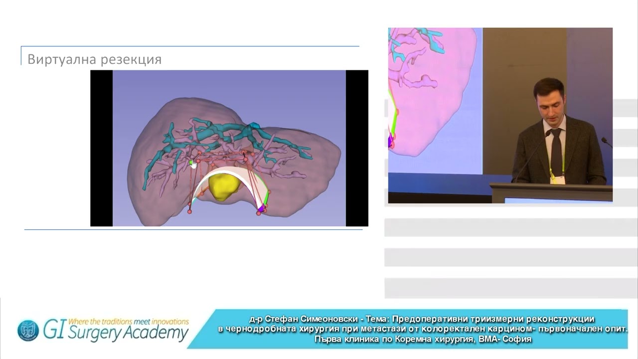 Preoperative 3D Reconstructions in Liver Surgery for Colorectal Cancer Metastases - Initial Experience