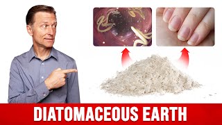 Download lagu The Benefits of Diatomaceous Earth for Humans mp3 Download lagu The Benefits of Diatomaceous Earth for Humans mp3