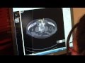 Amedo 3D LNS Lasergeführtes Navigationssystem Für CT Gesteuerte Interventionen