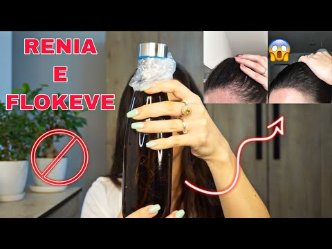 RECETA QE NDALON RENIEN E FLOKEVE DHE PERSHPEJTON DALJEN E FLOKEVE TE RINJ