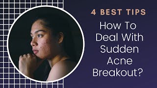 How To Deal With Sudden Acne Breakouts - 4 Best Tips || Get Rid Of Acne