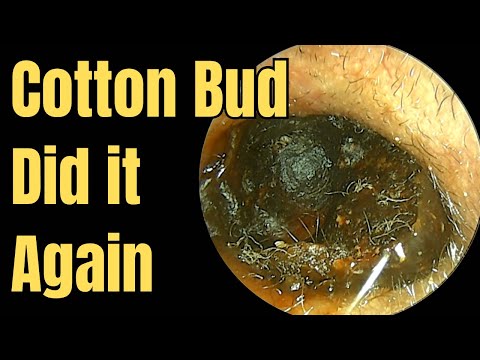 Cotton Bud Did it Again