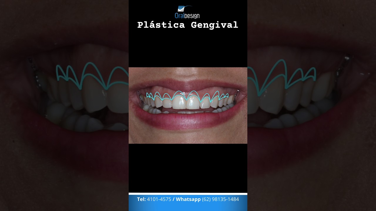 Danilo Monteiro Rezende Pereira-37