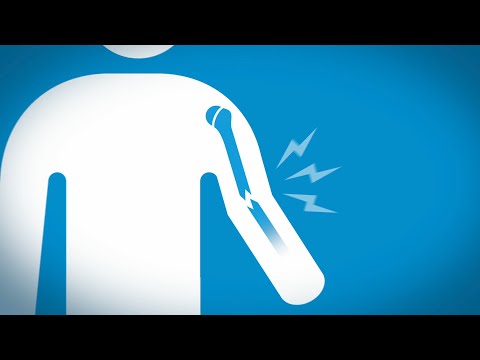 Growth plates: Why choose Children's Wisconsin?