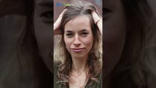 Begini Penampakan Ucie Sucita seusai TRANSPLANTASI RAMBUT, Jidat Jenongnya Jadi Tertutup