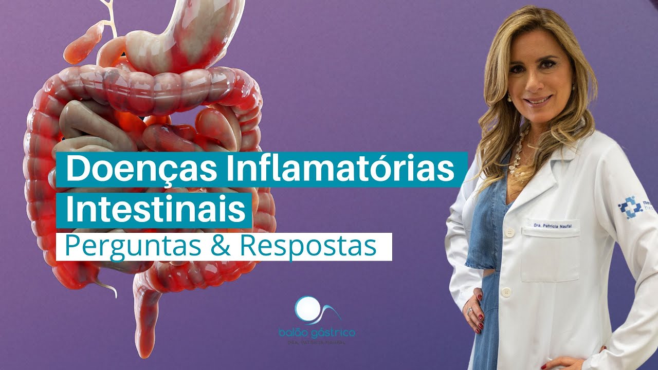 Doenças Inflamatórias Intestinais:  Perguntas e Respostas que Você Precisa Saber.