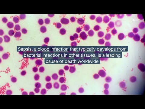 Bacterial extracellular vesicles repress RNase1 in human lung endothelial cells